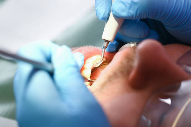 Best Emergency Dental Care for Abscessed Tooth in Oak Trail Shores, TX